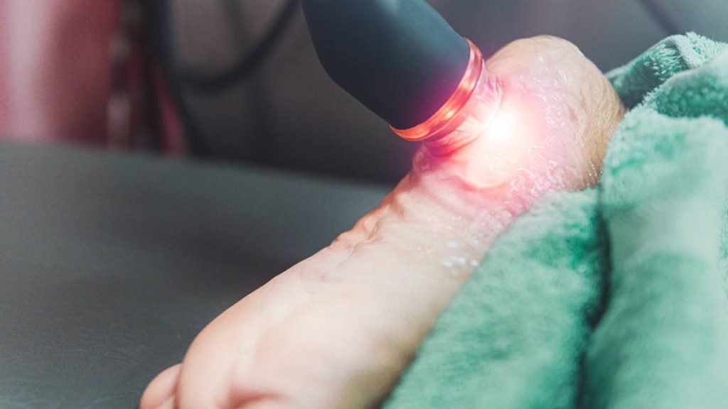 Láser Terapéutico en Fisioterapia: Beneficios y Aplicaciones